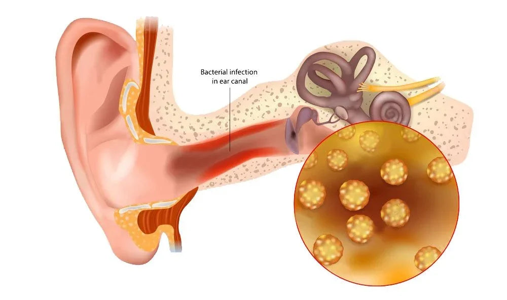 LIMPIADOR DE OIDOS TINNIDROP - ESCUCHA MEJOR, VIVE MEJOR