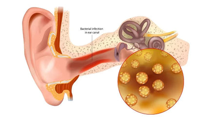LIMPIADOR DE OIDOS TINNIDROP - ESCUCHA MEJOR, VIVE MEJOR