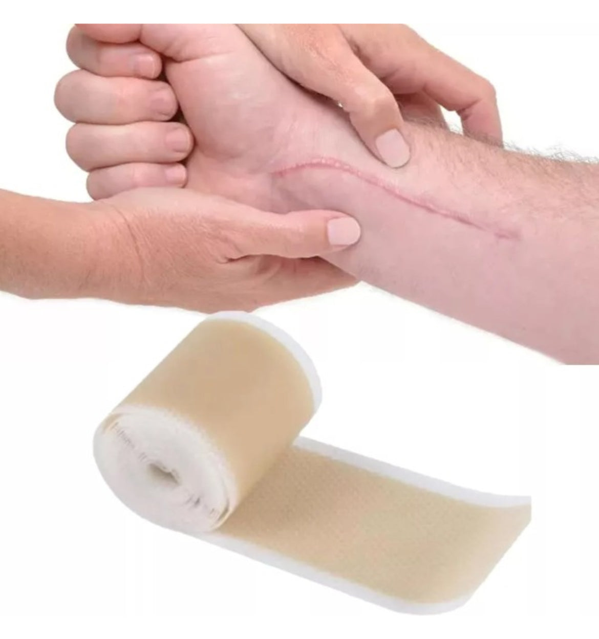 Parche de Silicona Médica para Cicatrices Antiguas/Nuevas - Elimina Quemaduras, Queloides, Estrías y Acné