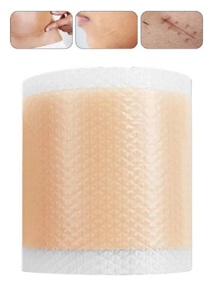 Parche de Silicona Médica para Cicatrices Antiguas/Nuevas - Elimina Quemaduras, Queloides, Estrías y Acné