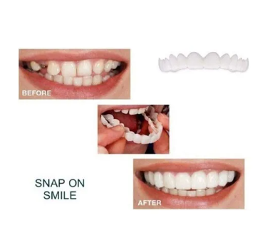 Carillas Dentales Perfecta Sonrisa Smile1