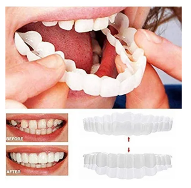 Carillas Dentales Snap On Smile